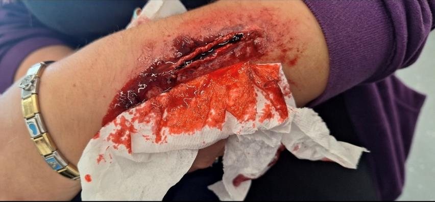 Deep gash wound effect