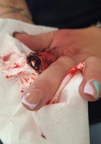 Hand injury special effects makeup